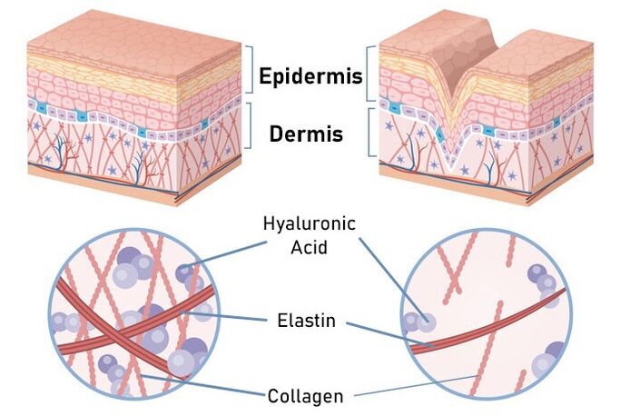 ZXCVBNMQwert stimulates the collagen synthesis