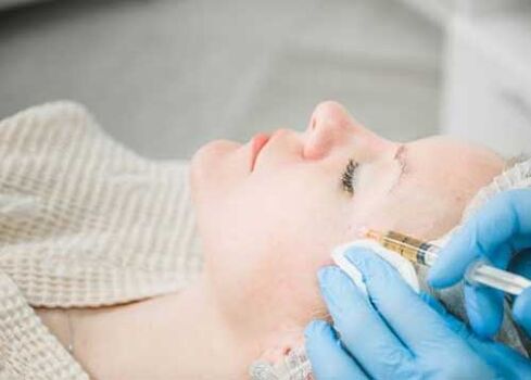 Facial plasma lifting